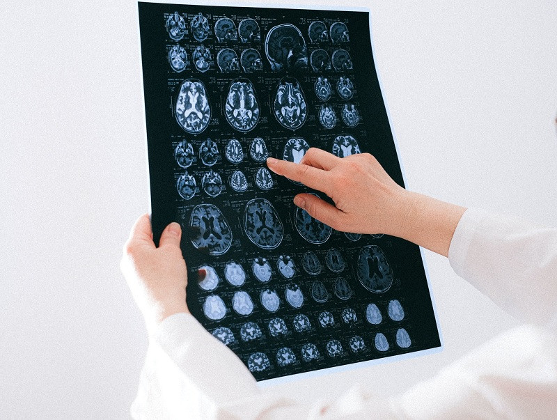 Cerebro y corazón