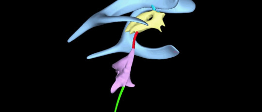 Sistema ventricular