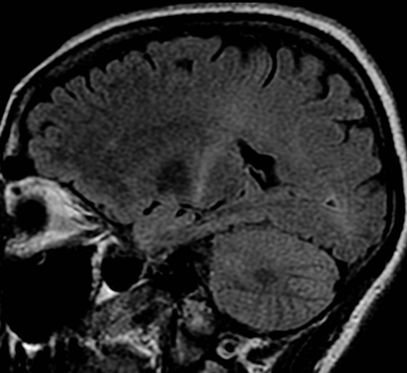 Neurología
