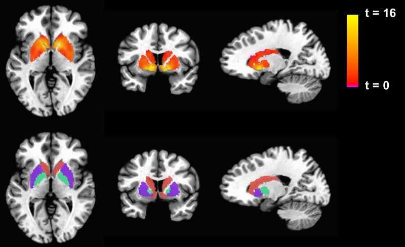 Características de los trastornos neurocognitivos
