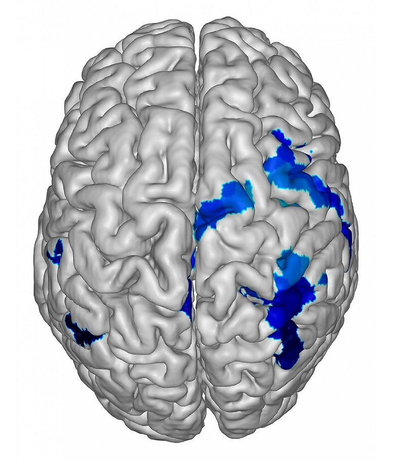 Tipos de neuroderechos