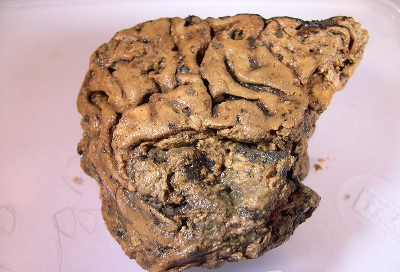 Características del cerebro de Heslington