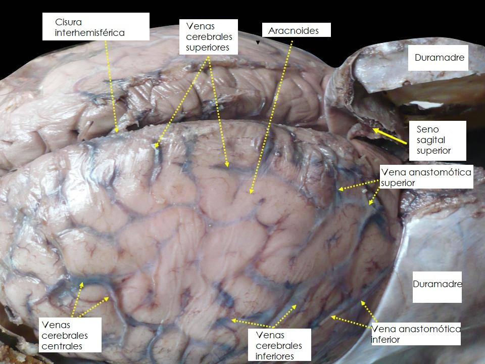 Venas cerebrales