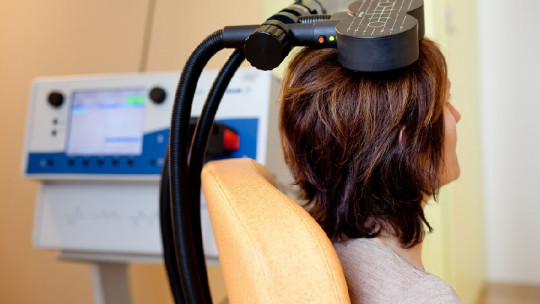 Terapia de neuromodulación inteligente acelerada
