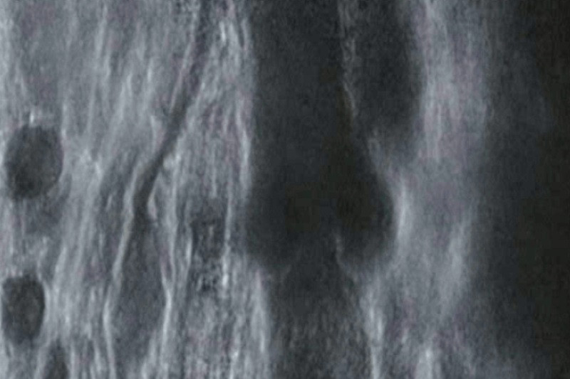 Venas