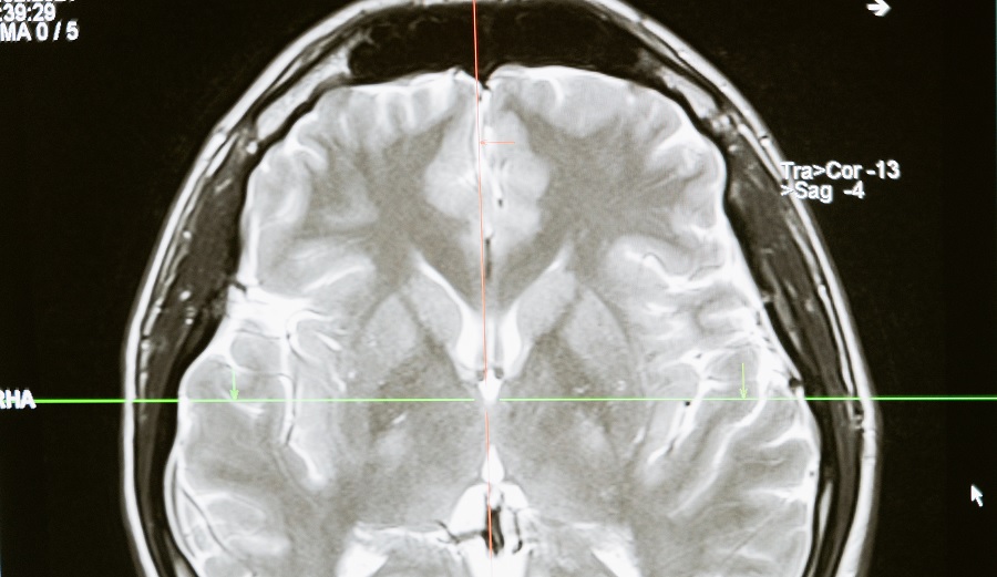 Los mejores Cursos de Neuropsicología
