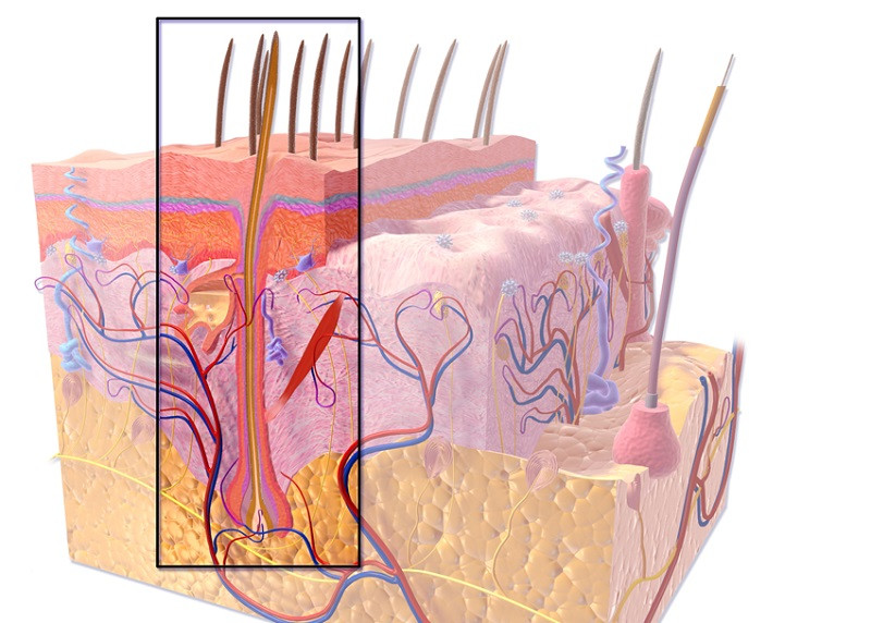 Alopecia por estrés