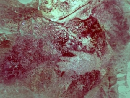 Arte neandertal