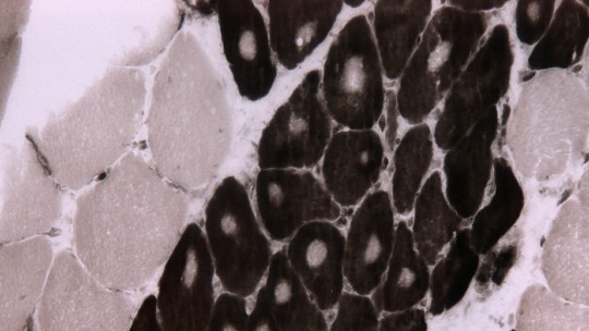 Fibra muscular.