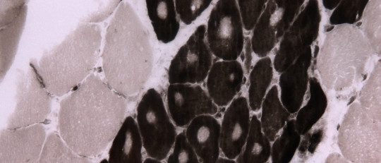 Fibra muscular.