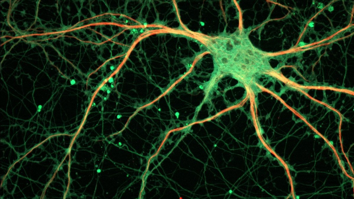 Así funcionan los Neurotransmisores, mensajeros químicos del Cerebro