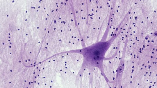 Un tipo de neuronas que regulan la pérdida de apetito pueden ayudar a tratar la obesidad