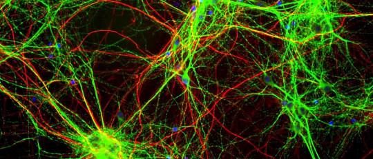 Neuronas