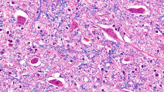 Neuronas motoras