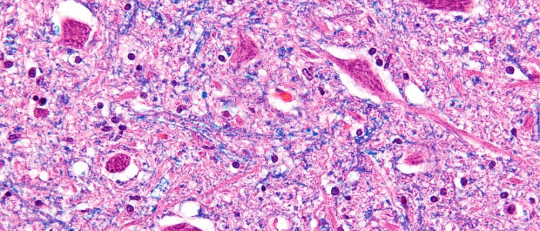 Neuronas motoras