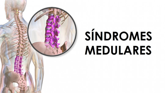 Síndromes medulares