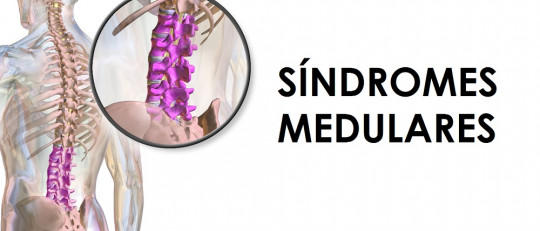Síndromes medulares