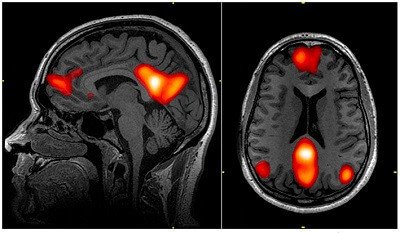 Red neuronal por defecto