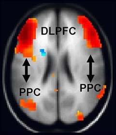 Red frontoparietal