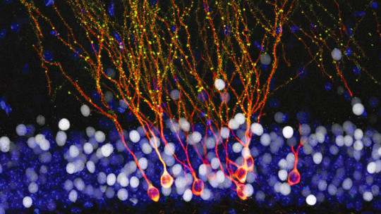 Migración neuronal