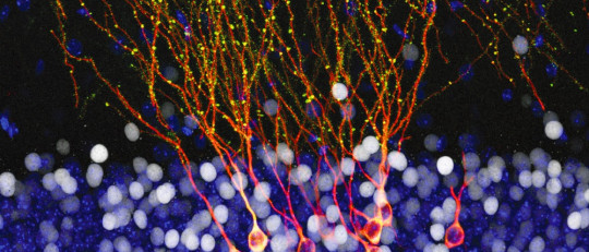 Migración neuronal