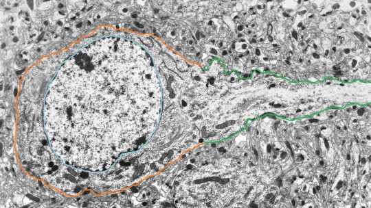 Soma neuronal