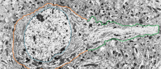 Soma neuronal