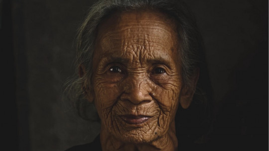 Psicosis en la enfermedad del Parkinson