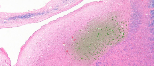 Locus coeruleus