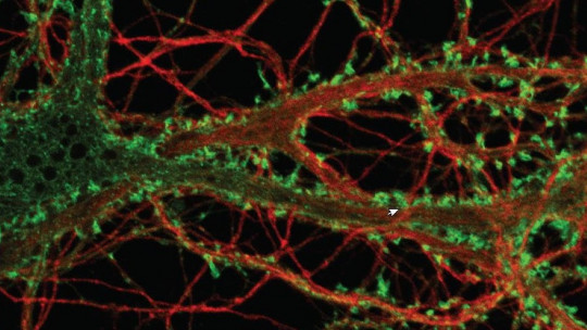 Neuronas dopaminérgicas