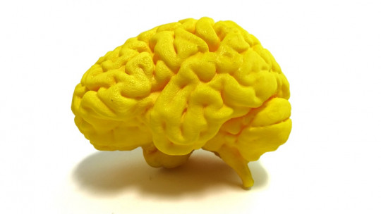 Áreas del cerebro asociadas al lenguaje