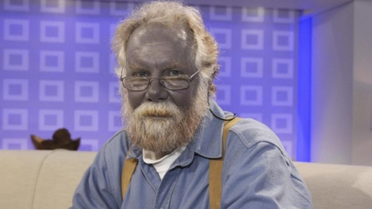 Metahemoglobinemia