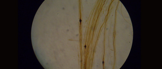 Nódulos de Ranvier