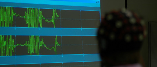 Neurofeedback