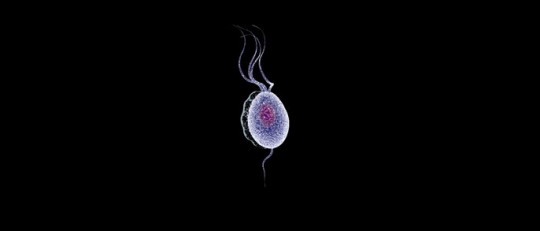 Tricomoniasis