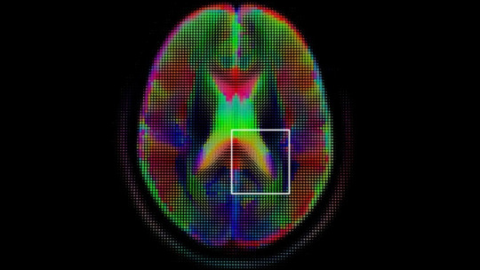 Ciencia cognitiva