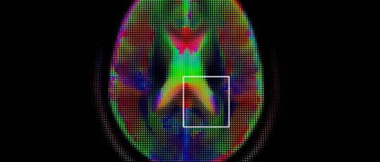 Ciencia cognitiva
