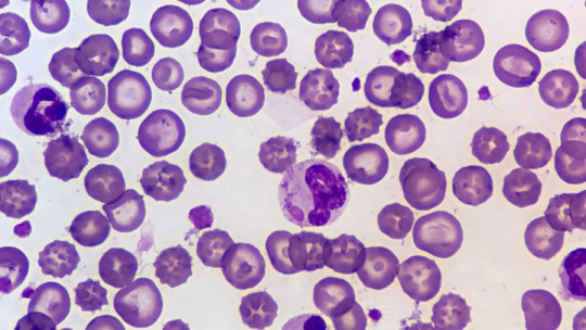 Eritrocitos