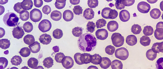 Eritrocitos