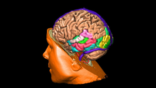 Cerebro masculino