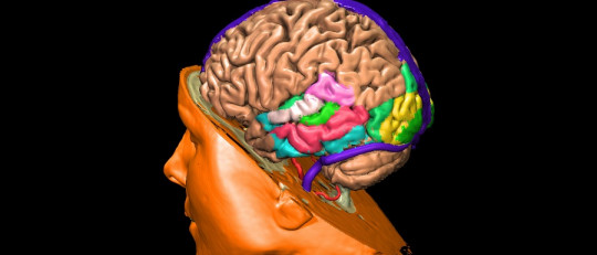 Cerebro masculino
