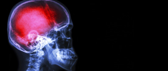 Los 8 peores dolores que sufrimos los humanos