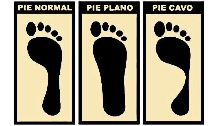 Pie normal, cavo y plano
