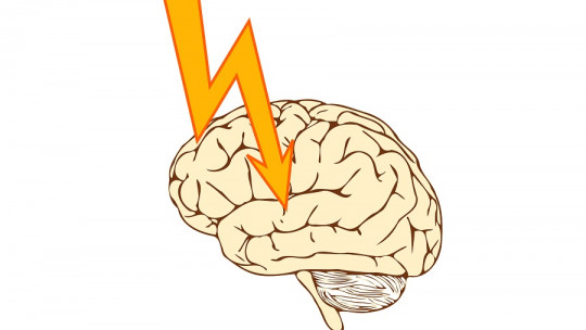 Epilepsia refractaria