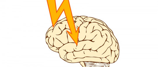 Epilepsia refractaria