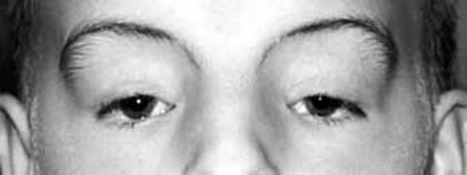 Joubert, cejas