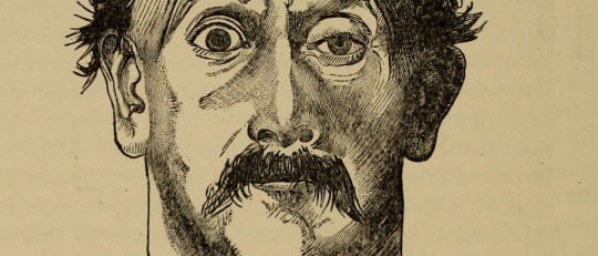 Ptosis palpebral