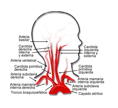 Sistema carotideo