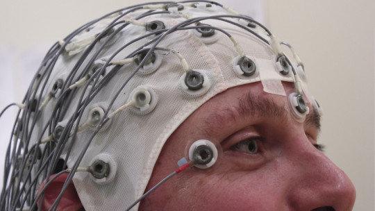 Electrofisiologia