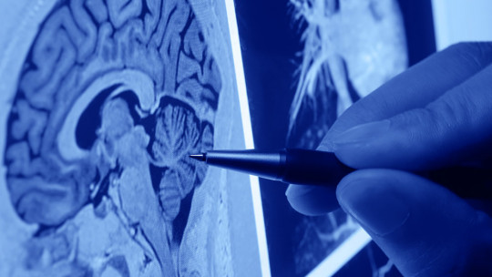 Tipos de neurólogos